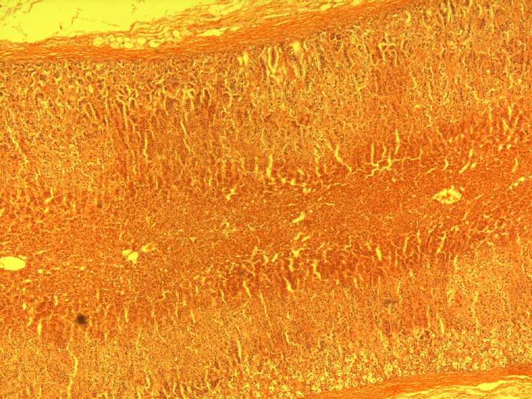 adrenal gland