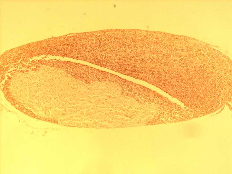 pituitary