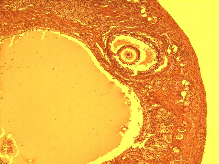 ovary