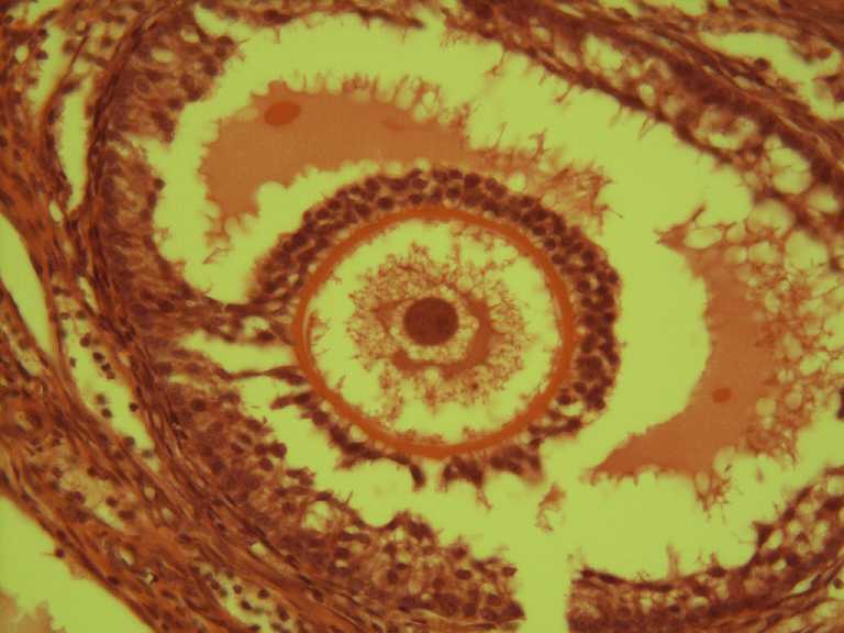 ovary