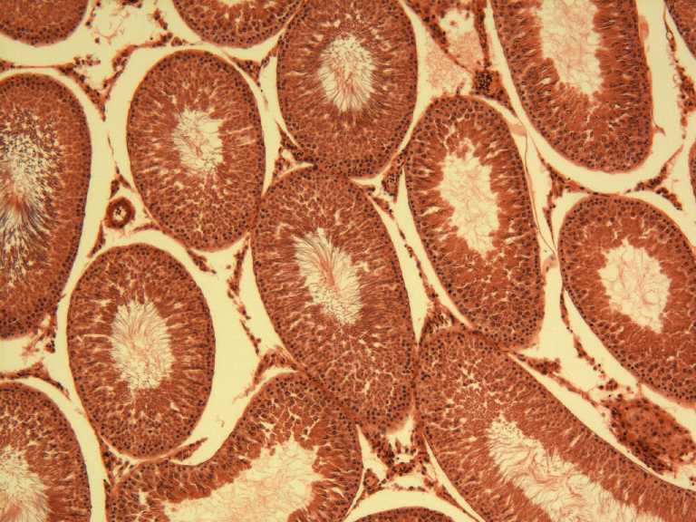 testis