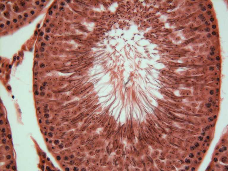 testis