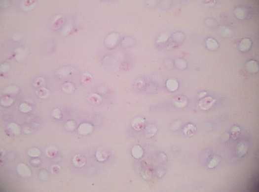 hyaline