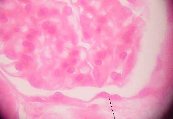 simple squamous