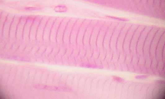 striated muscle
