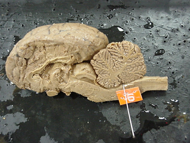 4th ventricle