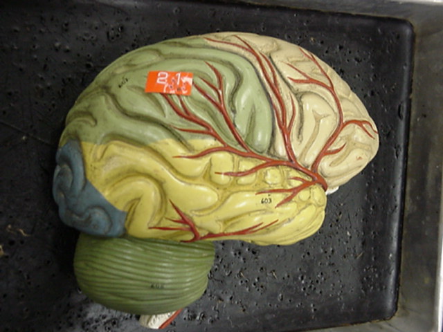 parietal lobe