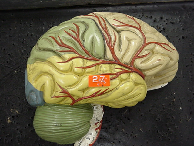 temporal lobe