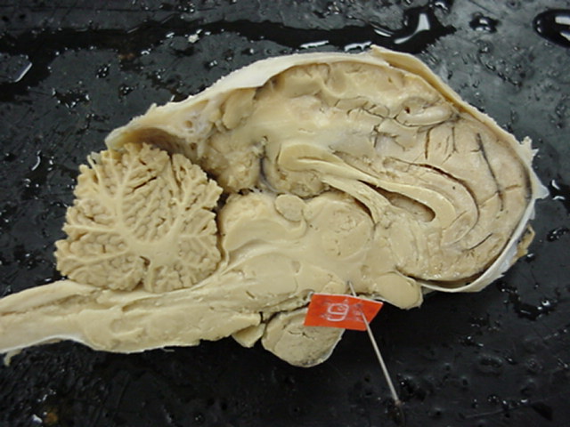 hypothalamus