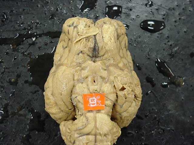 hypothalamus