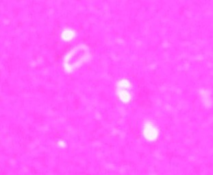 capsule stain