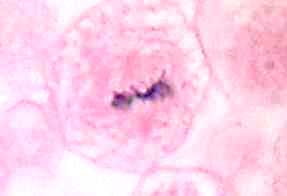 metaphase