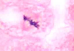 metaphase