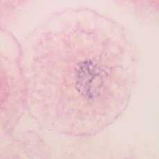 prophase
