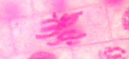 metaphase