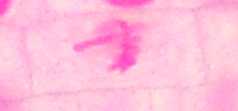 metaphase