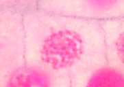 prophase