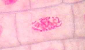 prophase