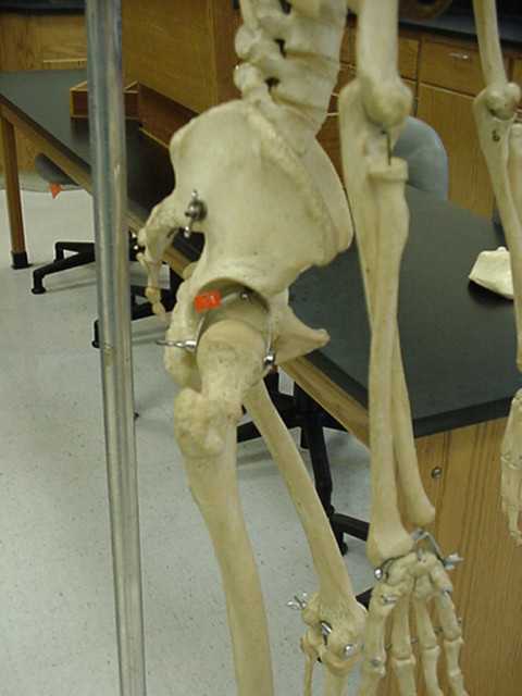 acetabulum