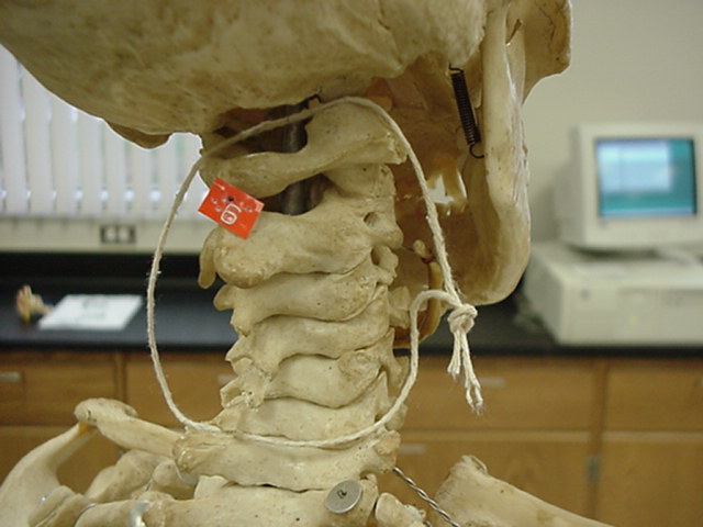 cervical vertebrae