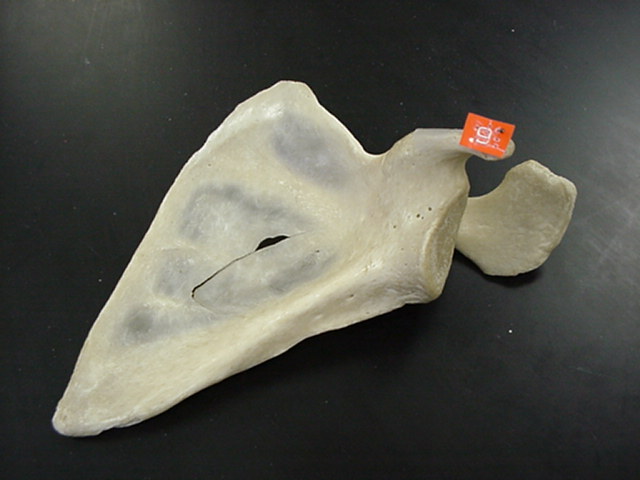 coracoid process of scapula
