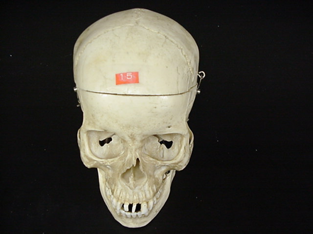 frontal bone