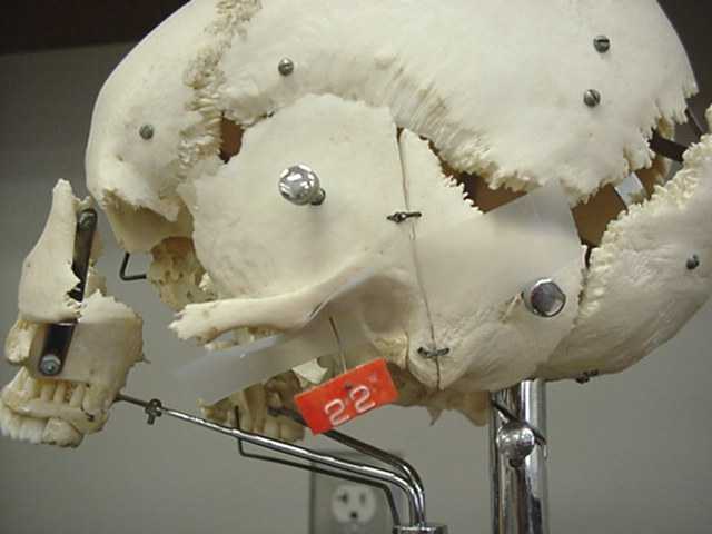 mandibular fossa