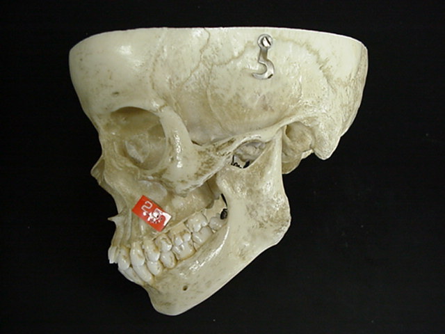 maxilla