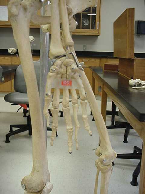metacarpals