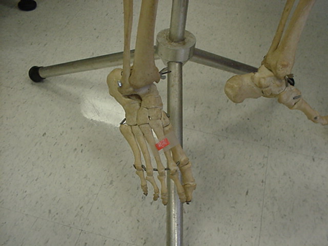 metatarsal