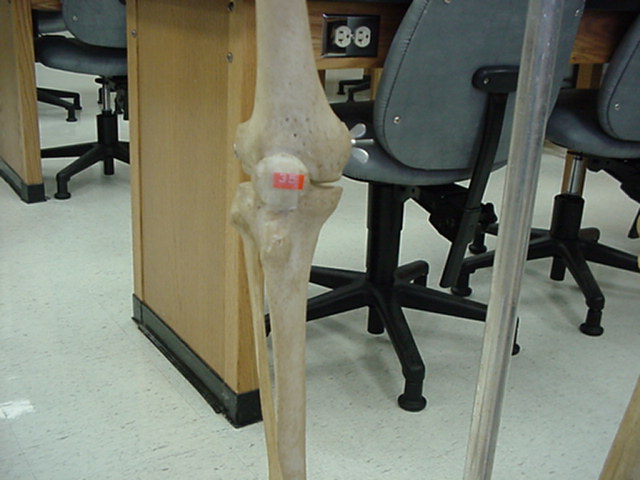 patella