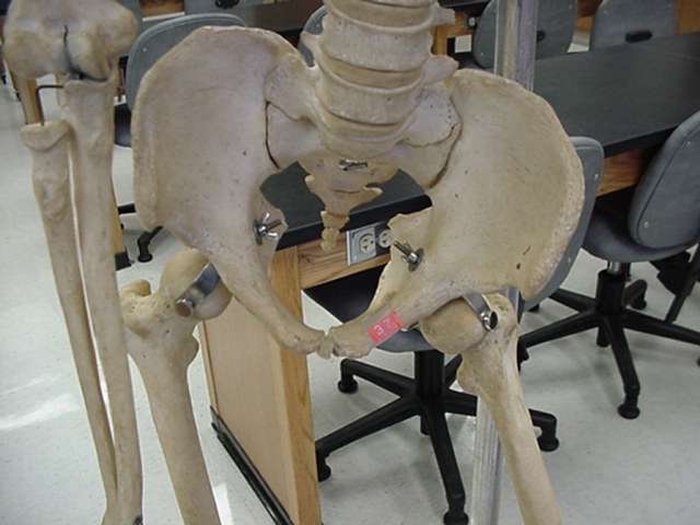 pubis of coxal bone
