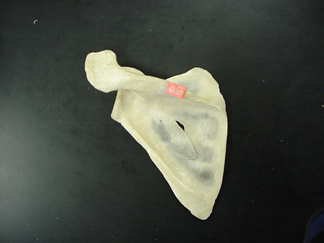 scapular spine