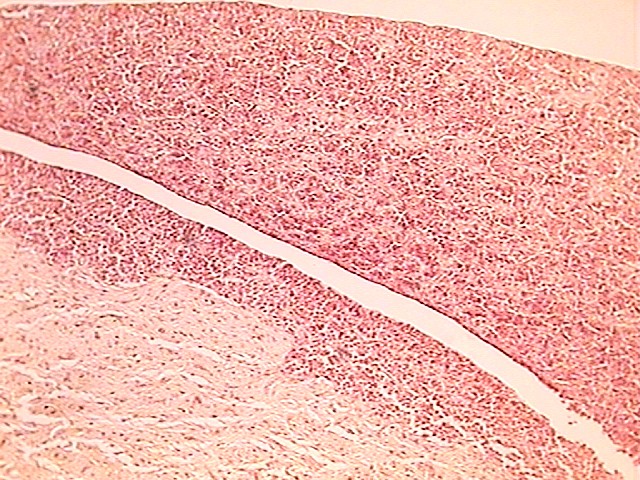 pituitary