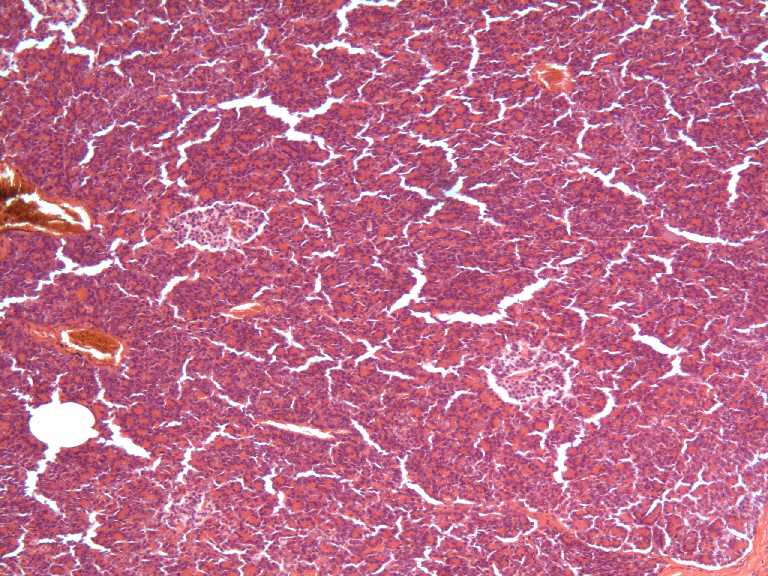 pancreas
