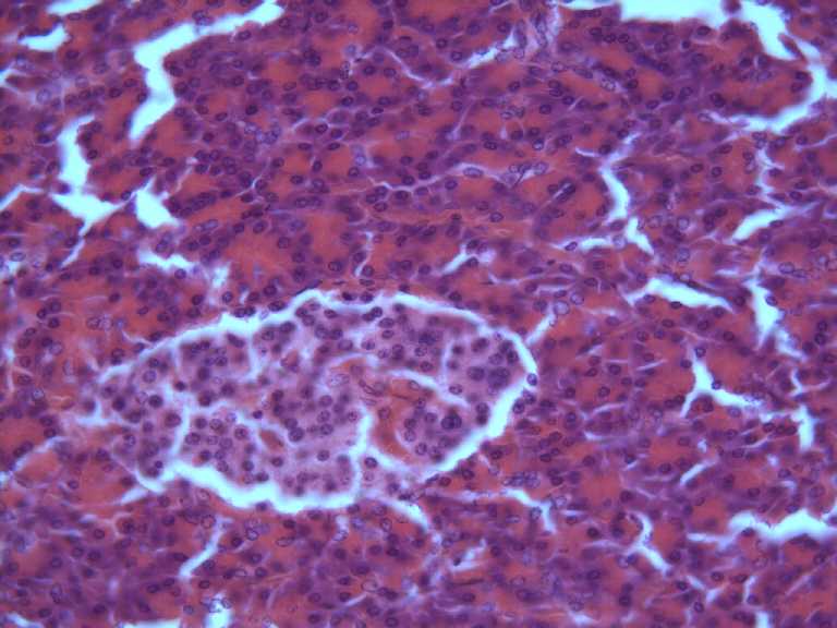 pancreas