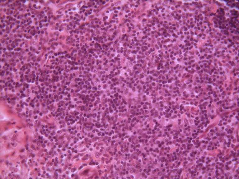 parathyroid