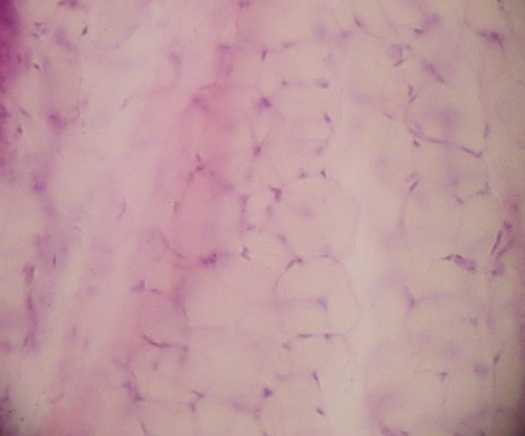 adipose