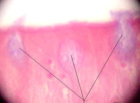 goblet cell