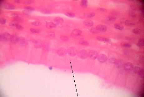 simple columnar