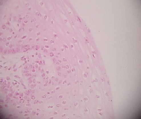 stratified squamous