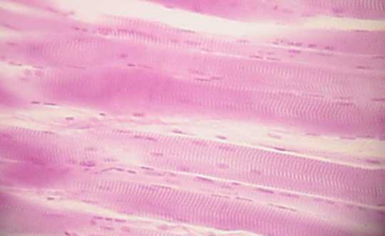 striated muscle