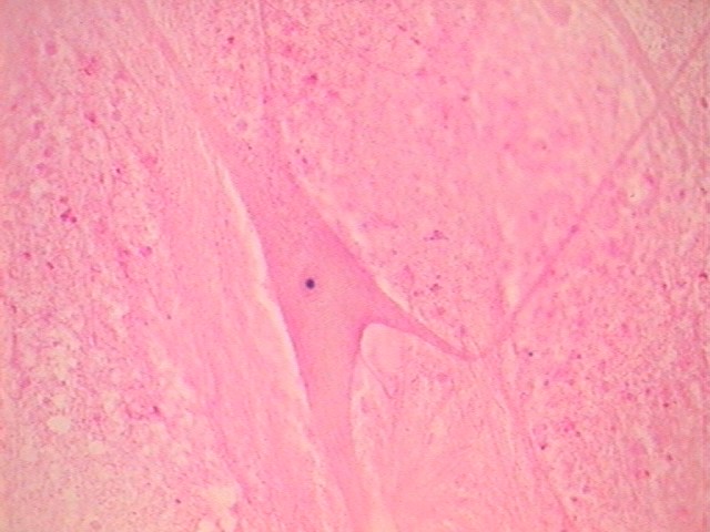 neuron