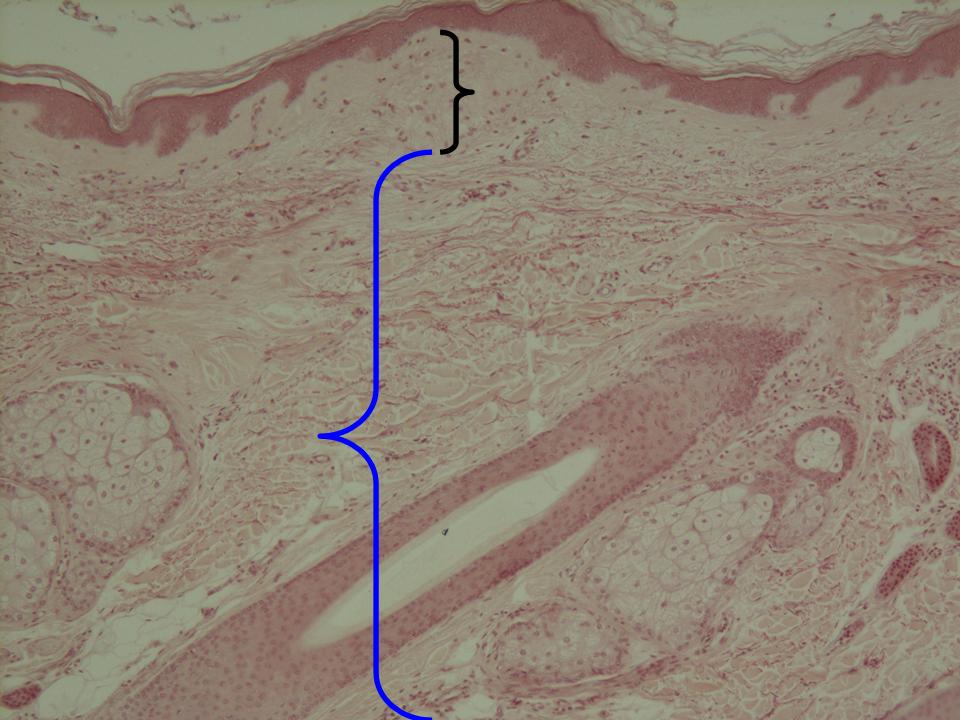 Dermis