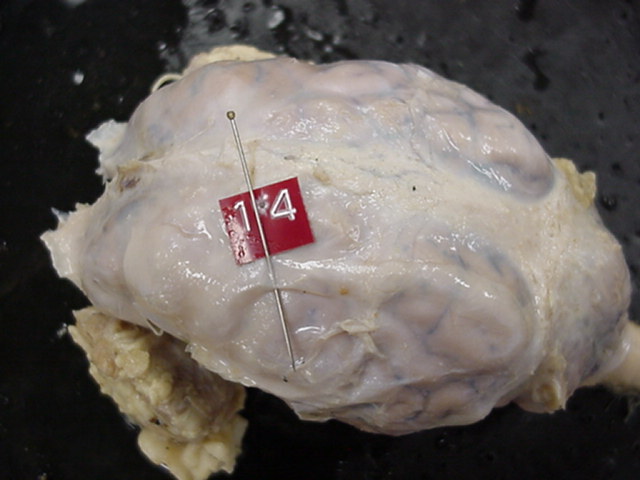 dura mater
