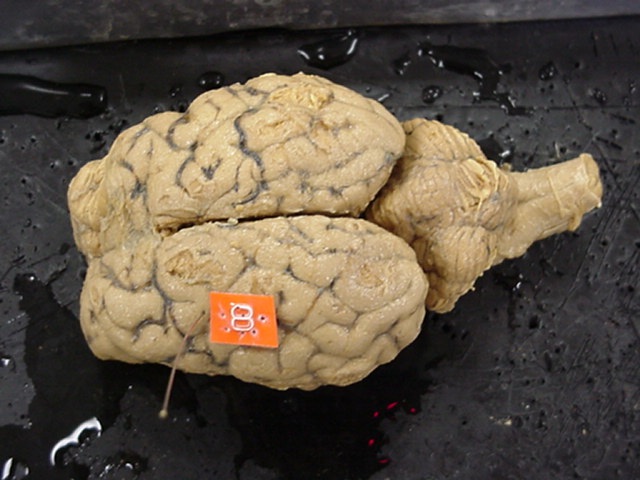 gyrus