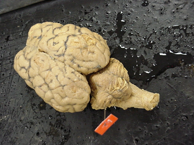 cerebellum