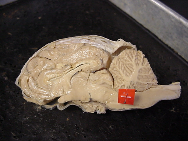 cerebellum