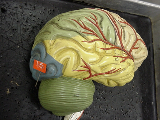 occipital lobe