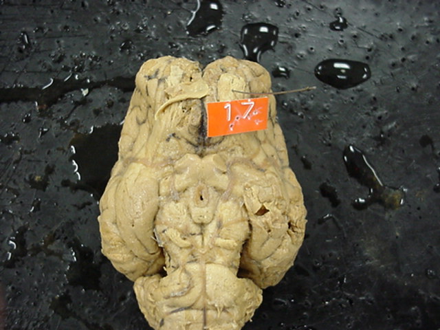 olfactory bulb